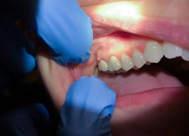 Best Weekend Emergency Dentist in Troy, NC