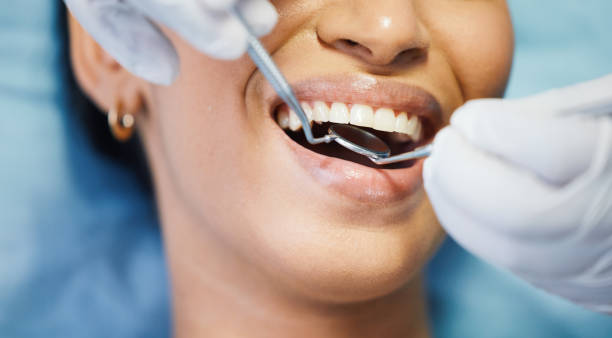 Best Emergency Treatment for Toothache in Troy, NC